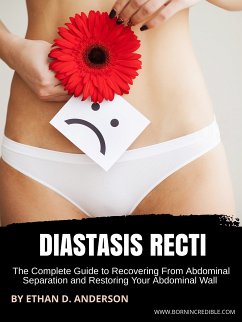 Diastasis Recti (eBook, ePUB) - D. Anderson, Ethan