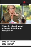 Thyroid gland: rare primary location of lymphoma
