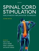 Spinal Cord Stimulation (eBook, ePUB)