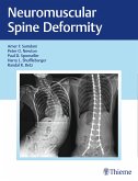Neuromuscular Spine Deformity (eBook, PDF)