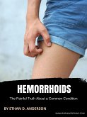 Hemorrhoids (eBook, ePUB)