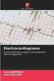 Electrocardiograma