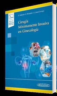 Cirugía Mínimamente Invasiva en Ginecología