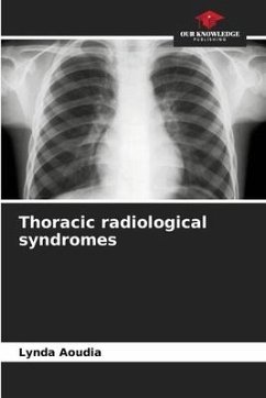 Thoracic radiological syndromes - Aoudia, Lynda