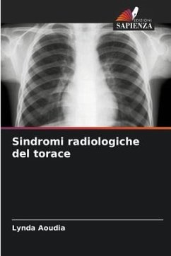 Sindromi radiologiche del torace - Aoudia, Lynda