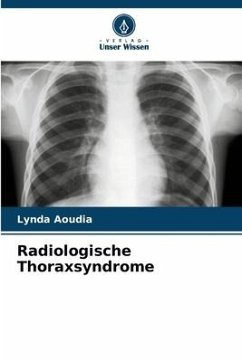 Radiologische Thoraxsyndrome - Aoudia, Lynda