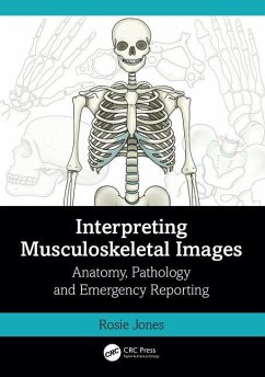 Interpreting Musculoskeletal Images - Jones, Rosie (Uni Hospitals of North Midlands)