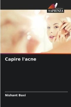 Capire l'acne - Baxi, Nishant