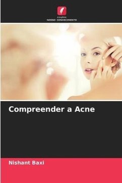 Compreender a Acne - Baxi, Nishant