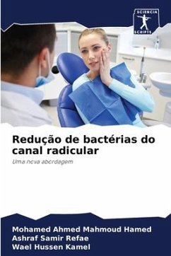 Redução de bactérias do canal radicular - Hamed, Mohamed Ahmed Mahmoud;Refae, Ashraf Samir;Kamel, Wael Hussen