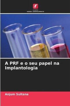 A PRF e o seu papel na Implantologia - Sultana, Anjum