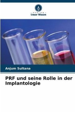 PRF und seine Rolle in der Implantologie - Sultana, Anjum