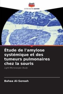 Étude de l'amylose systémique et des tumeurs pulmonaires chez la souris - Al-Sereah, Bahaa