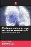 Um tumor pulmonar raro: carcinoma sarcomatóide