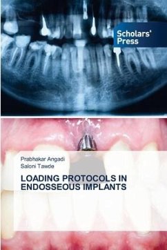 LOADING PROTOCOLS IN ENDOSSEOUS IMPLANTS - Angadi, Prabhakar;Tawde, Saloni