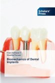 Biomechanics of Dental Implants