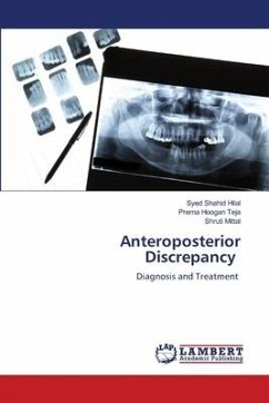 Anteroposterior Discrepancy