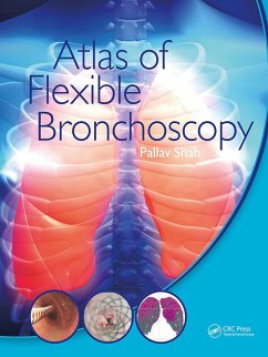 Atlas of Flexible Bronchoscopy - Shah, Pallav (MD FRCP Consultant Physician and Honorary Senior Lectu