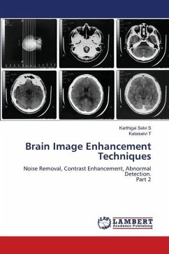 Brain Image Enhancement Techniques - S, Karthigai Selvi;T, Kalaiselvi