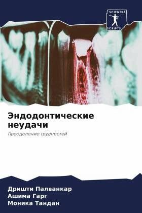 Jendodonticheskie neudachi