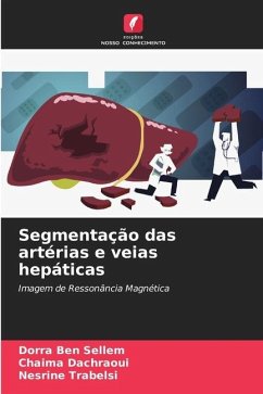 Segmentação das artérias e veias hepáticas - Ben Sellem, Dorra;Dachraoui, Chaima;Trabelsi, Nesrine