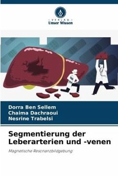 Segmentierung der Leberarterien und -venen - Ben Sellem, Dorra;Dachraoui, Chaima;Trabelsi, Nesrine