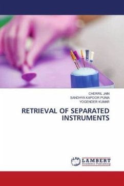 RETRIEVAL OF SEPARATED INSTRUMENTS