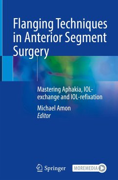 Flanging Techniques in Anterior Segment Surgery