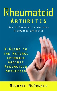 Rheumatoid Arthritis - Mcdonald