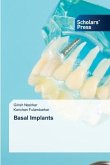 Basal Implants