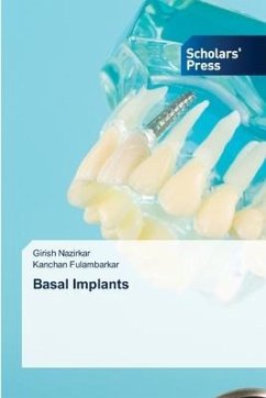 Basal Implants - Nazirkar, Girish;Fulambarkar, Kanchan