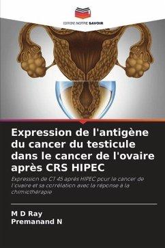 Expression de l'antigène du cancer du testicule dans le cancer de l'ovaire après CRS HIPEC - Ray, M D;N, Premanand