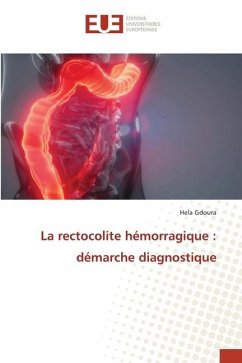 La rectocolite hémorragique : démarche diagnostique - Gdoura, Hela