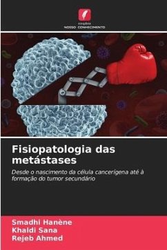 Fisiopatologia das metástases - Hanène, Smadhi;Sana, Khaldi;Ahmed, Rejeb