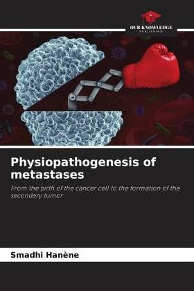 Physiopathogenesis of metastases