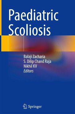 Paediatric Scoliosis