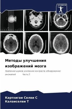 Metody uluchsheniq izobrazhenij mozga - S, Karthigai Selwi;T, Kalaiselwi