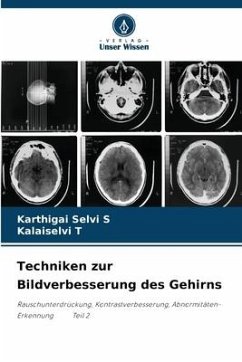 Techniken zur Bildverbesserung des Gehirns - S, Karthigai Selvi;T, Kalaiselvi