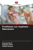 Prothèses sur implants - Réexamen