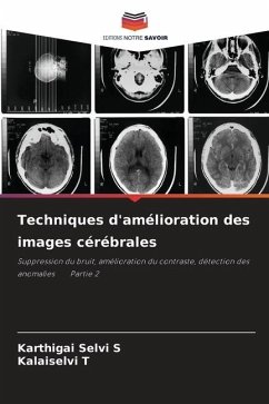 Techniques d'amélioration des images cérébrales - S, Karthigai Selvi;T, Kalaiselvi