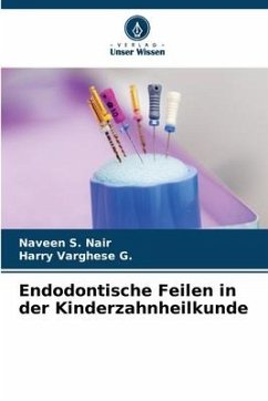 Endodontische Feilen in der Kinderzahnheilkunde - Nair, Naveen S.;G., Harry Varghese