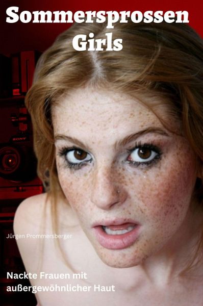 Sommersprossen Girls (eBook, ePUB) Sommersprossen Girls (eBook, ePUB)