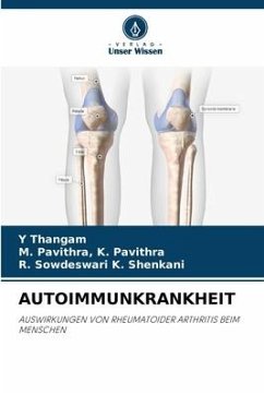 AUTOIMMUNKRANKHEIT - Thangam, Y;K. Pavithra, M. Pavithra,;K. Shenkani, R. Sowdeswari