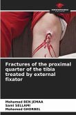 Fractures of the proximal quarter of the tibia treated by external fixator