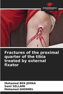 Fractures of the proximal quarter of the tibia treated by external fixator - Ben Jemaa, Mohamed;Sellami, Sami;Ghorbel, Mohamed