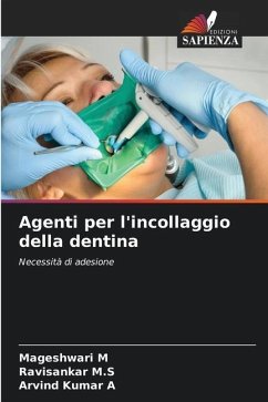 Agenti per l'incollaggio della dentina - M, Mageshwari;M.S, Ravisankar;A, Arvind Kumar