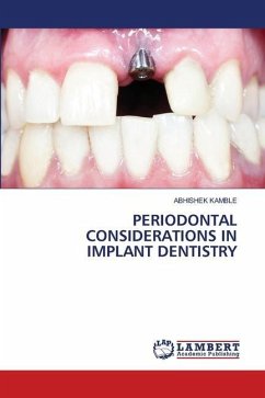 PERIODONTAL CONSIDERATIONS IN IMPLANT DENTISTRY