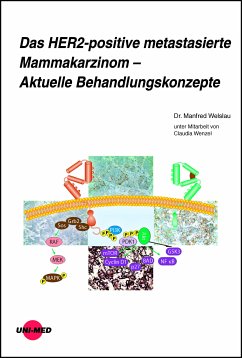 Das HER2-positive metastasierte Mammakarzinom - Aktuelle Behandlungskonzepte (eBook, PDF) - Welslau, Manfred