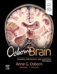 Osborn's Brain - Osborn, Anne G.; Linscott, Luke L.; Salzman, Karen L.