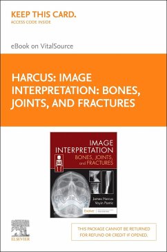 Image Interpretation: Bones, Joints, and Fractures -Elsevier E-Book on Vitalsource (Retail Access Card) - Harcus, James; Pantic, Voyin
